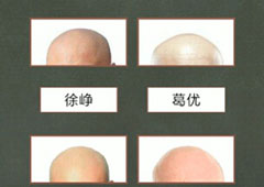 还有这种操作4第10关攻略 第10关怎么过